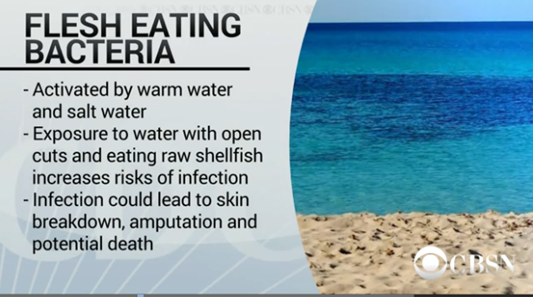 Florida beachgoers warned about deadly flesheating bacteria