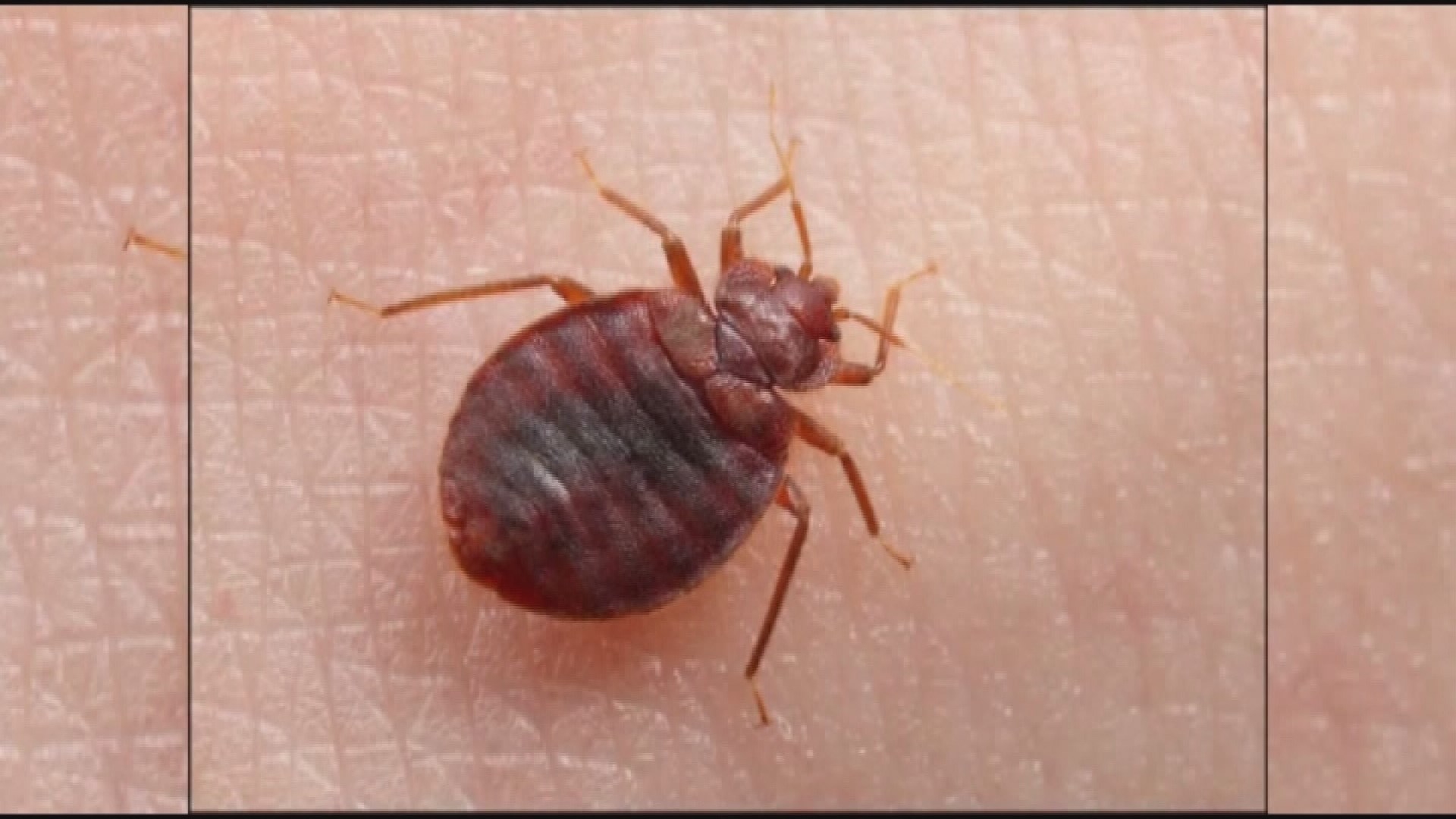 School's bed bug outbreak worrying parents