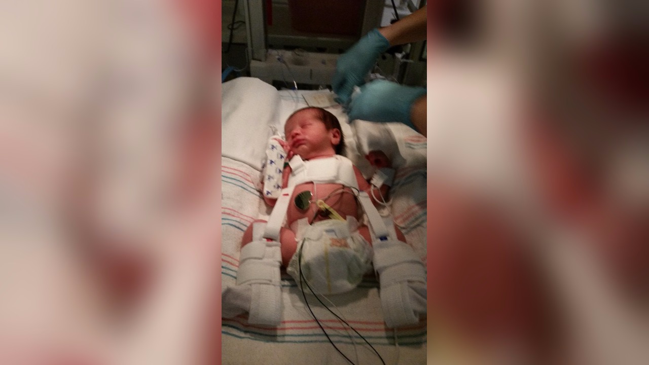 baby s leg broken during birth parents upset photo baby s leg broken during birth parents upset photo