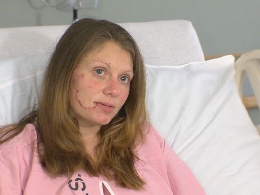 Pregnant stabbing victim speaks from hospital bed | khou.com